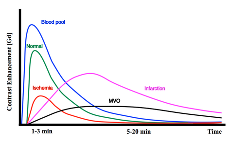 Gd myocardial enhancement