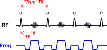 SSFP sequence