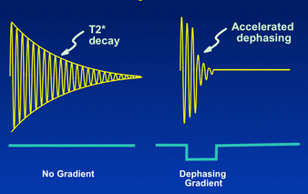 Gradient Echo (GRE)