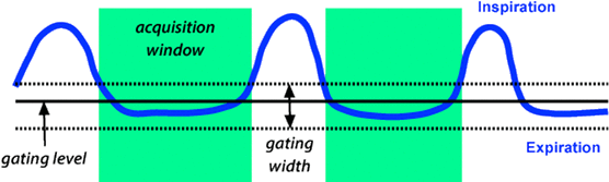 respiratory gating