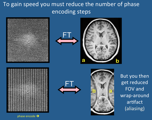 Parallel Imaging