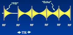 steady-state free precession (SSFP)