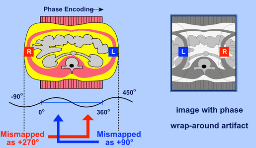 phase wrap-around artifact