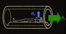 MRI B1 field