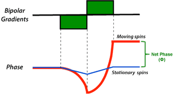 Phase Contrast MRA