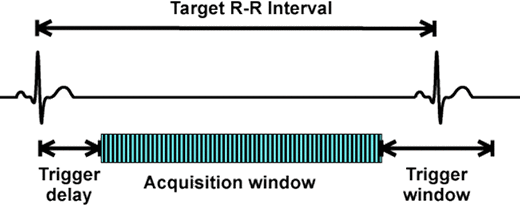 Cardiac MRI gating parameters