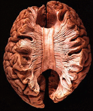 White matter fiber tracts