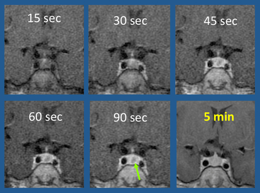 Dynamic contrast-enhanced (DCE) imaging