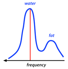 MR center frequency